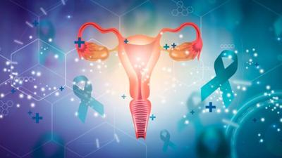 Endometriosis Linked to Four-fold Higher Odds for Ovarian Cancer